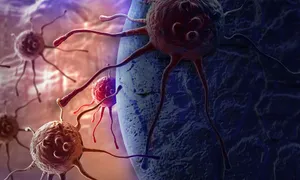 Phát hiện ung thư gan từ cơn đau hạ sườn